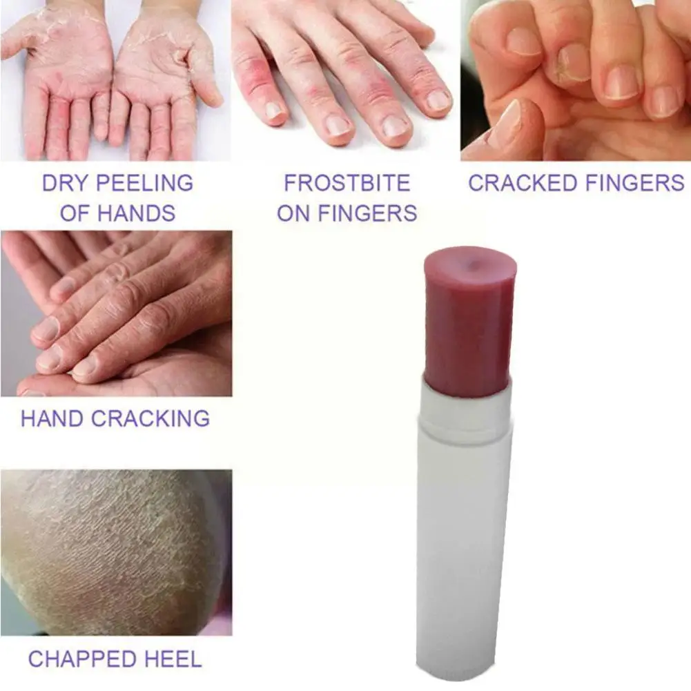 Женский Профессиональный питательный отбеливающий крем Lithospermum для рук с