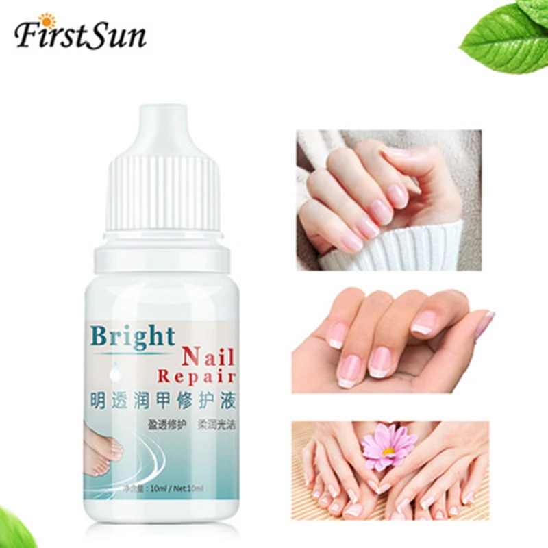 

100% Really WORK Kills Fungus Nail Fungus Treatment Feet Cream Onychomycosis Paronychia Anti Fungal Gel Nail Infection 10ml