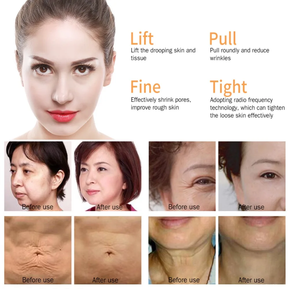 

Radiofrequency Facial RF Radio Frequency Lifting Face Lift Body SKin anti Wrinkle Removal Skin Tightening Beauty
