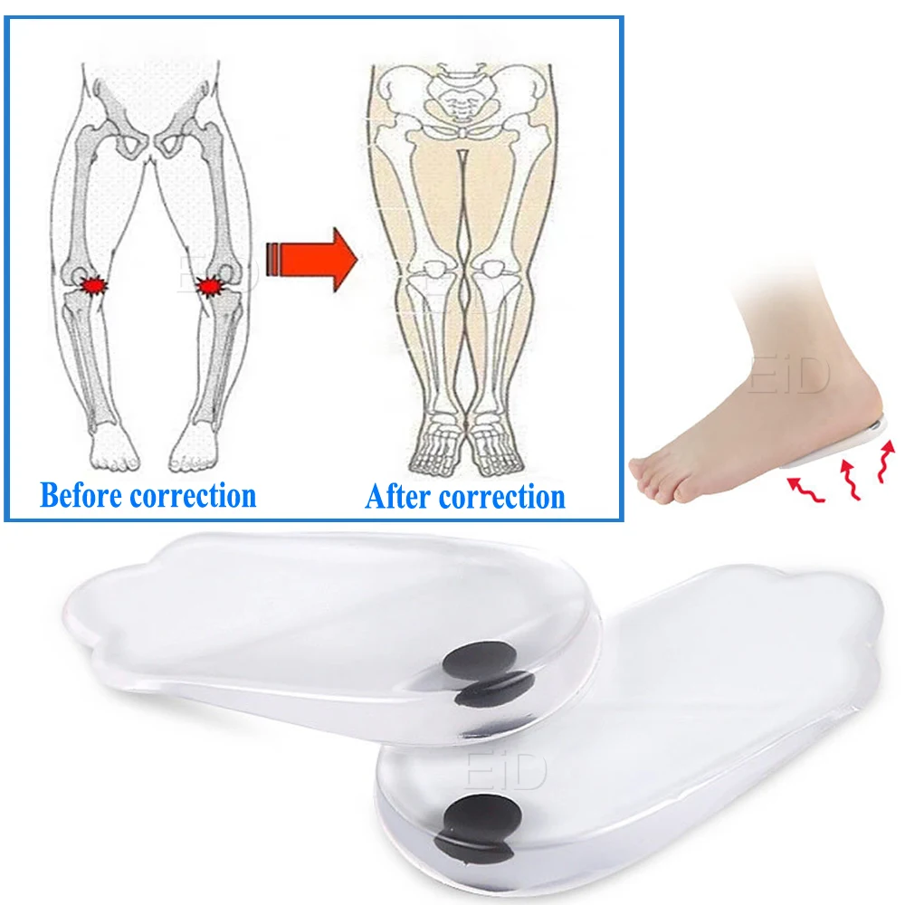 XO магнитные ортопедические стельки силиконовые гелевые супинаторы вставки для