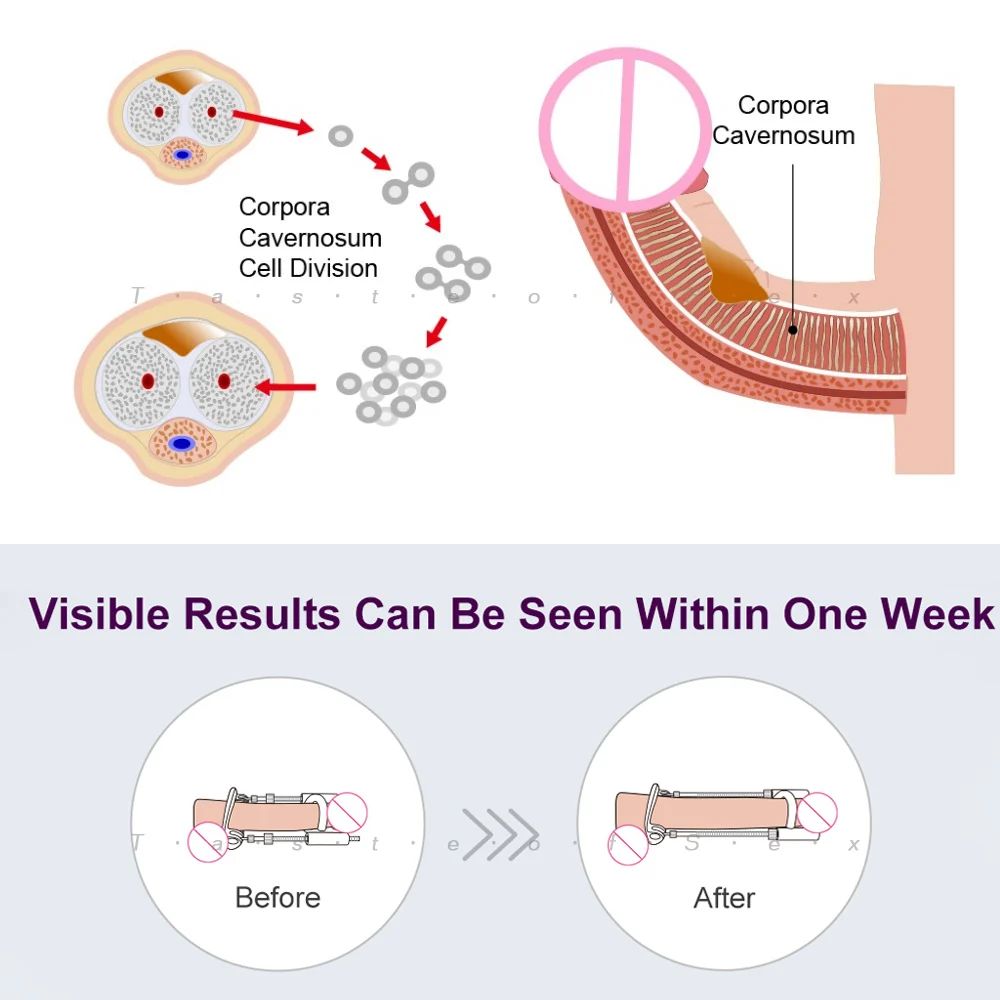 3 й массажный Растяжитель Для мужчин увеличитель пениса насос для увеличения