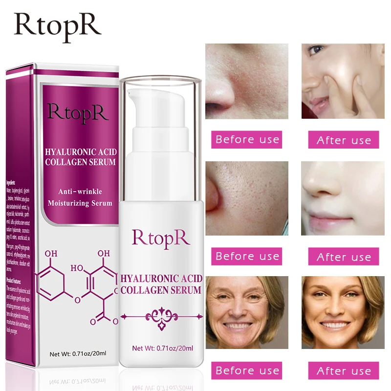 Коллагеновая Сыворотка для лица с гиалуроновой кислотой отбеливающая