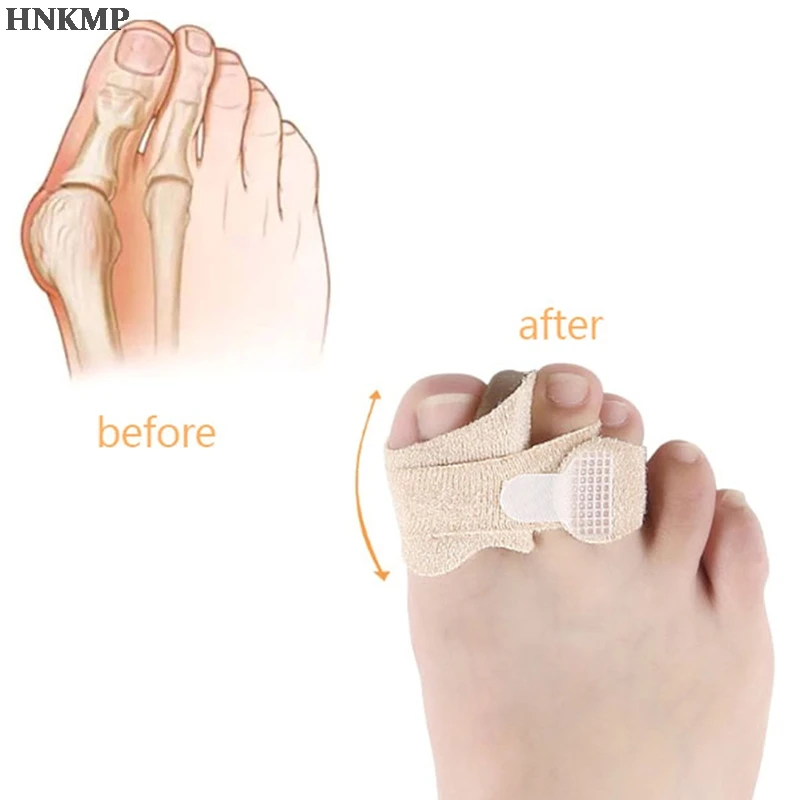 1 шт./2 шт. исправление вальгусной деформации первого пальца стопы силиконовые