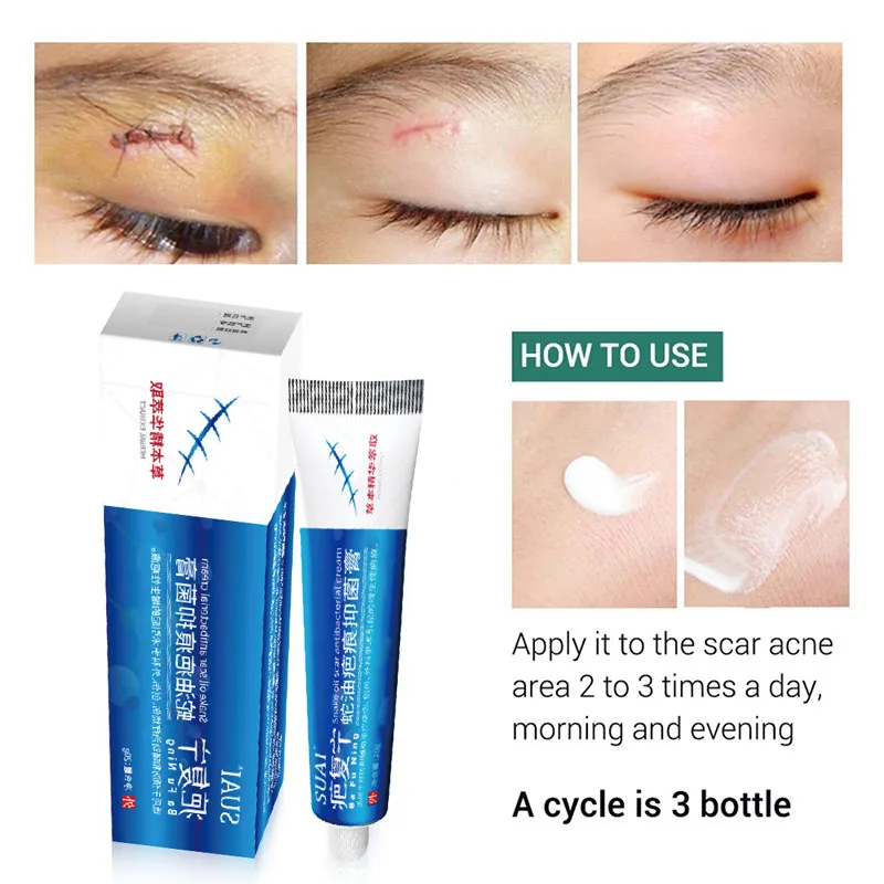 

Acne Scar Removal Cream Pimples Remover Stretch Marks Whitening Cream Anti-Acne Smoothing Repairing Whitening Body Skin Care 20g