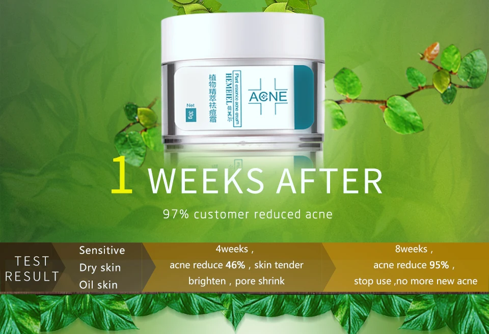 HEMEIEL уход за акне крем для лица Прыщи Шрам удаление черных точек сужение пор Отбеливание лица контроль маслом уход за кожей