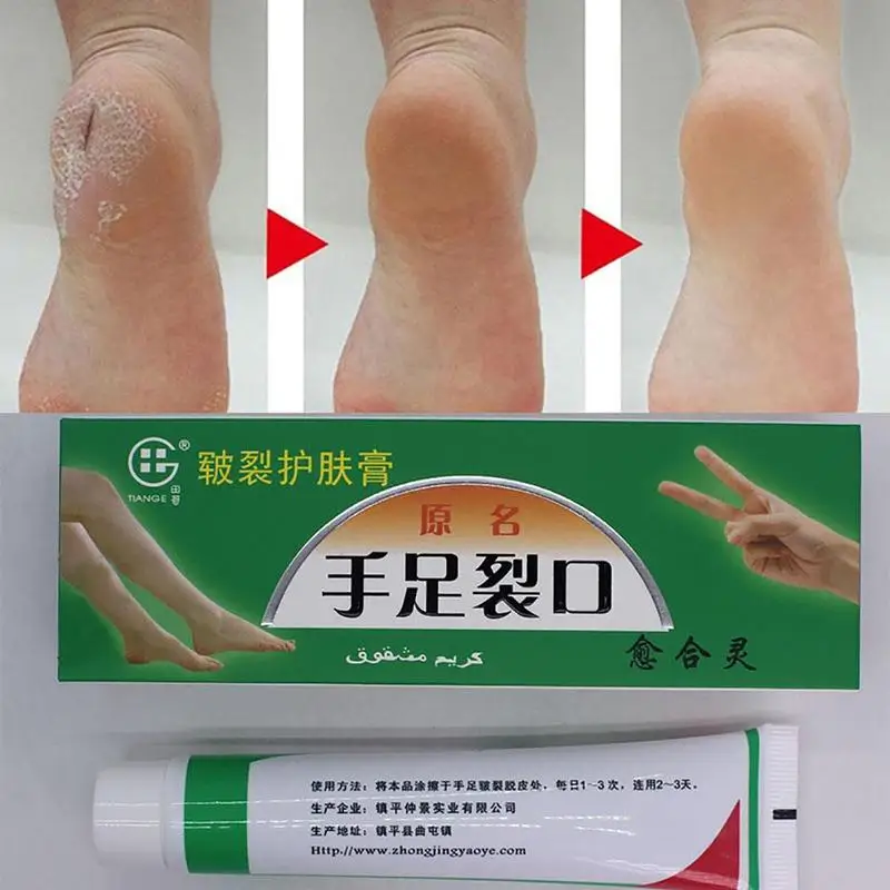 

Powerful Hand Foot Crack Cream Heel Chapped Peeling Foot and hand Repair Anti Dry Crack skin care Chinese Natural Ointment