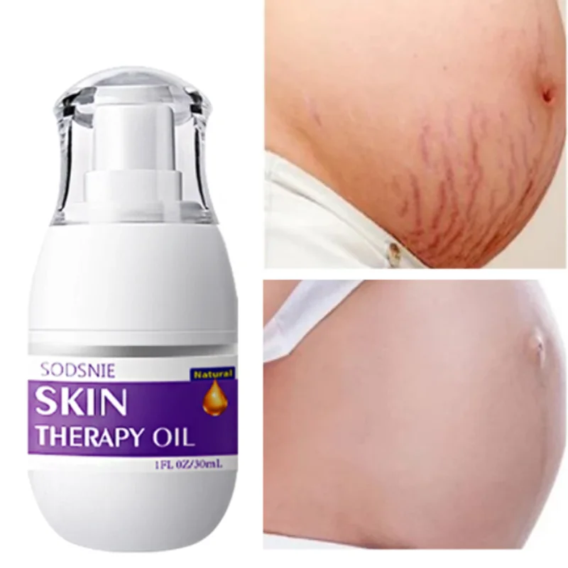 

Средство для удаления растяжек с эфирным маслом, 30 г