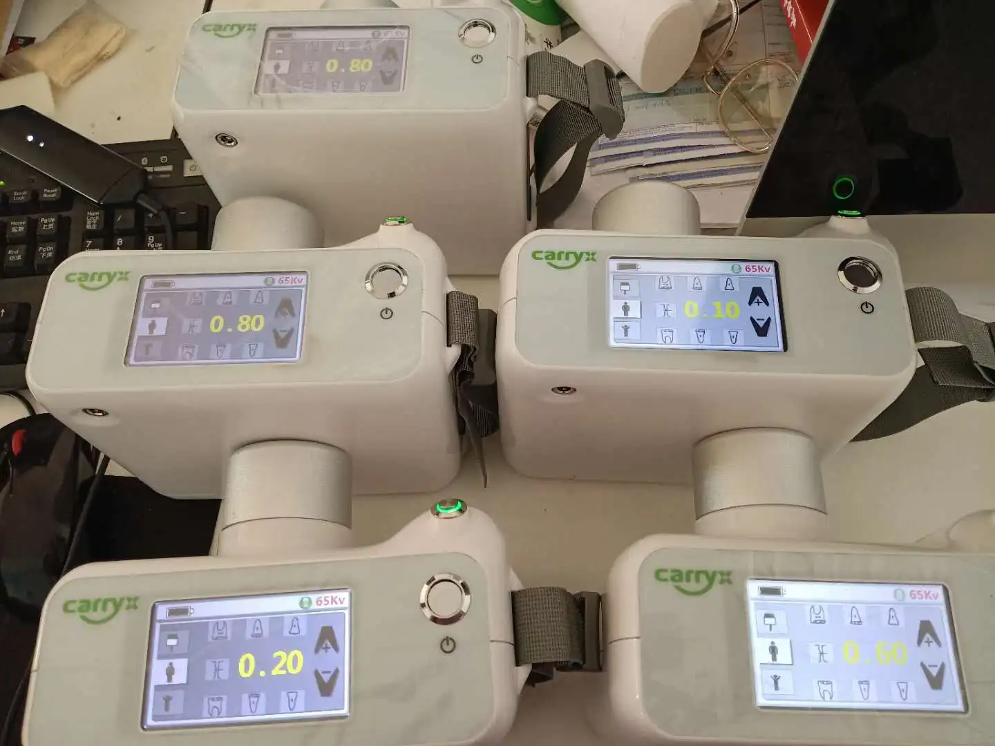 

CarryX brand 65Kv Digital Portable X Ray Toshiba Tube