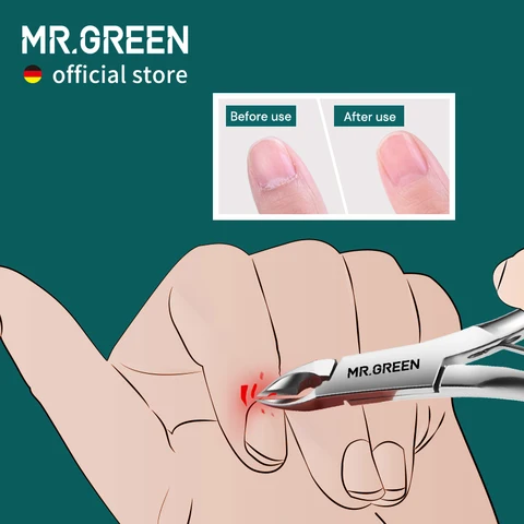 Кусачки для кутикулы MR.GREEN из нержавеющей стали — пример использования