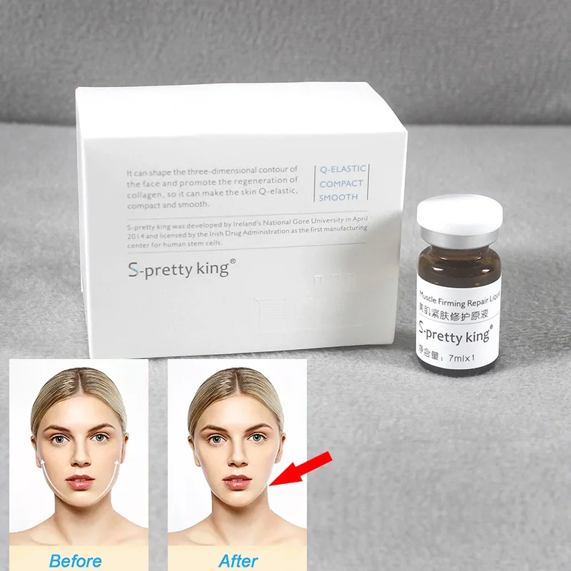Cross linked Wrinkle filler HA hyaluronic acid for anti wrinkle Beauty whitening skin face lifting injection pen 8ml 10ml 1:1 mi