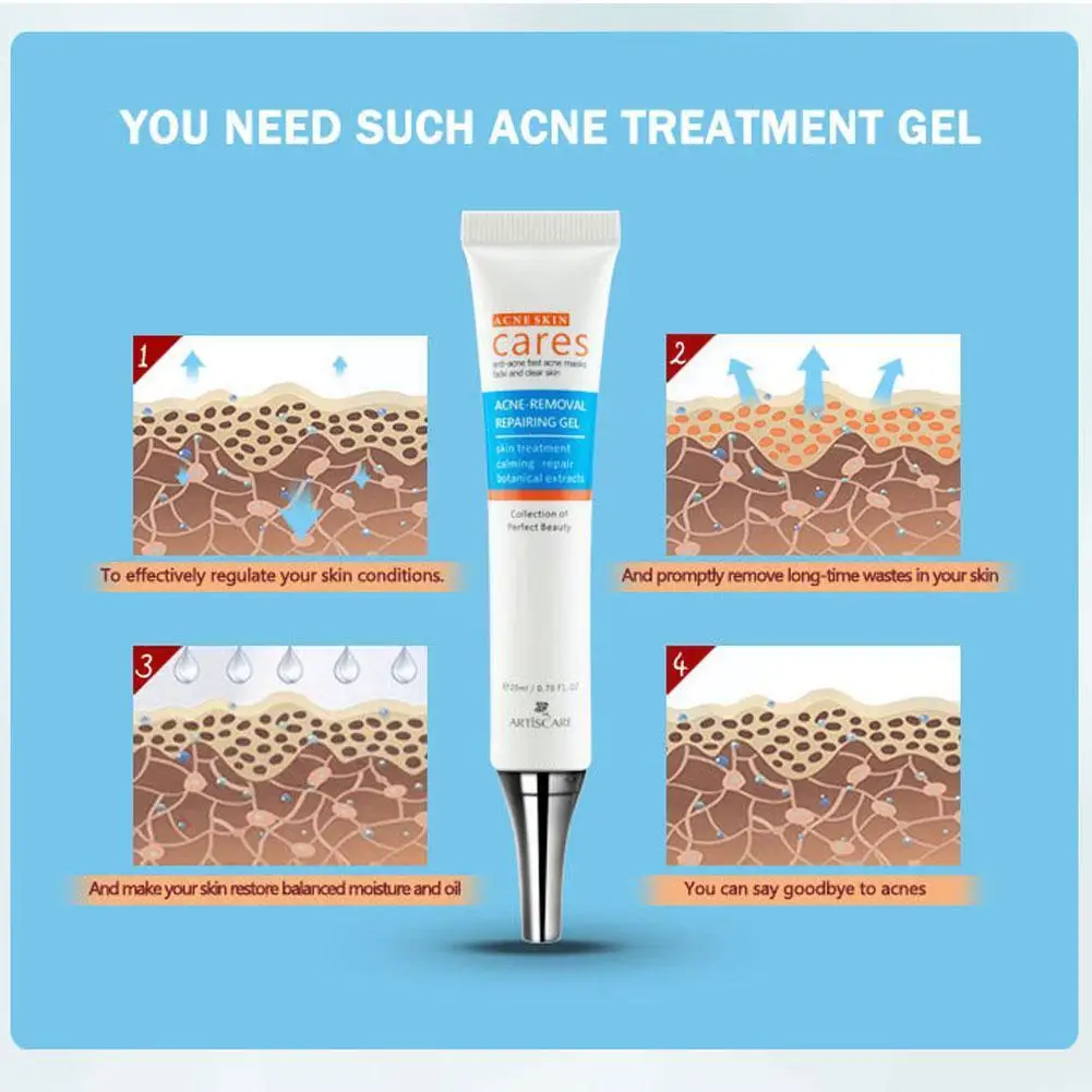 

20ml Effective Acne Removal Cream Anti-acne Repair Fade Skin Spots Acne Acne Face Moisturizing Treatments Gel Care Whitenin P1N9