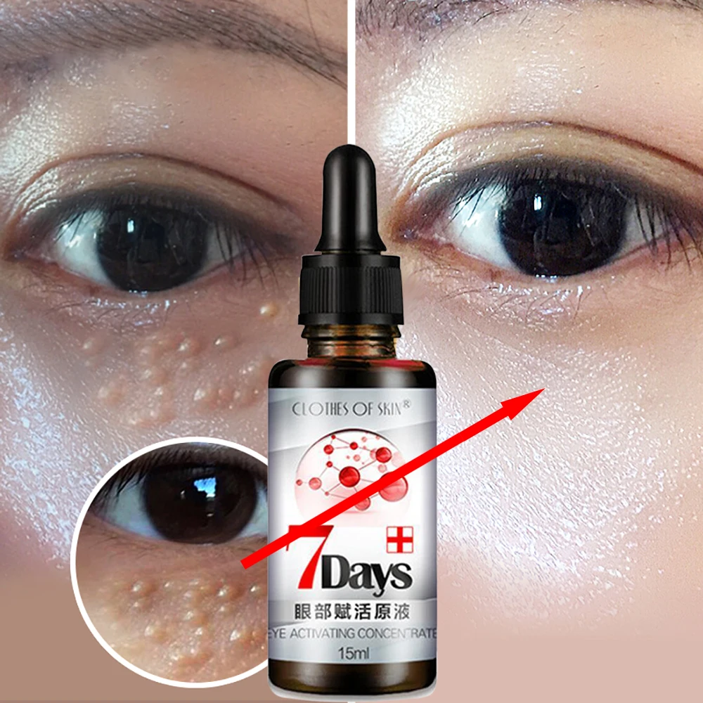 

2021Reduce Fat Granules Eye Serum Improve Eye Bag Dark Circles Eye Essence Remove Particles Anti-Puffiness Anti Wrinkle Eye Care