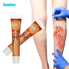 Мазь медицинская для снятия боли, 2 шт., крем против варикозного расширения вен