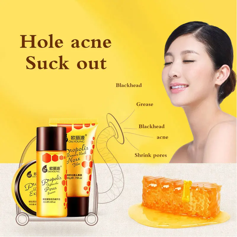 Прополис эссенция удаление черных точек маска набор глубокой очистки длительная