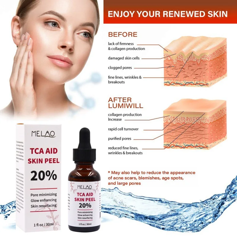 

30ml Trichloroaectic Acid 20% Skin Peel Pore Minizing Wrinkles Age Spots Skin Care Anti-wrinkle Face Care Serum