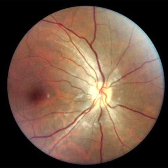 Портативный портативный ретинограф для Ретинальной Камеры|Запчасти и