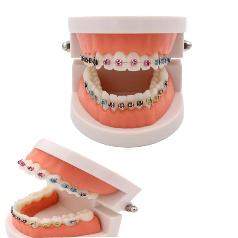 1 шт. Стоматологическая модель зуба с кронштейном Ортодонтическая обучающая