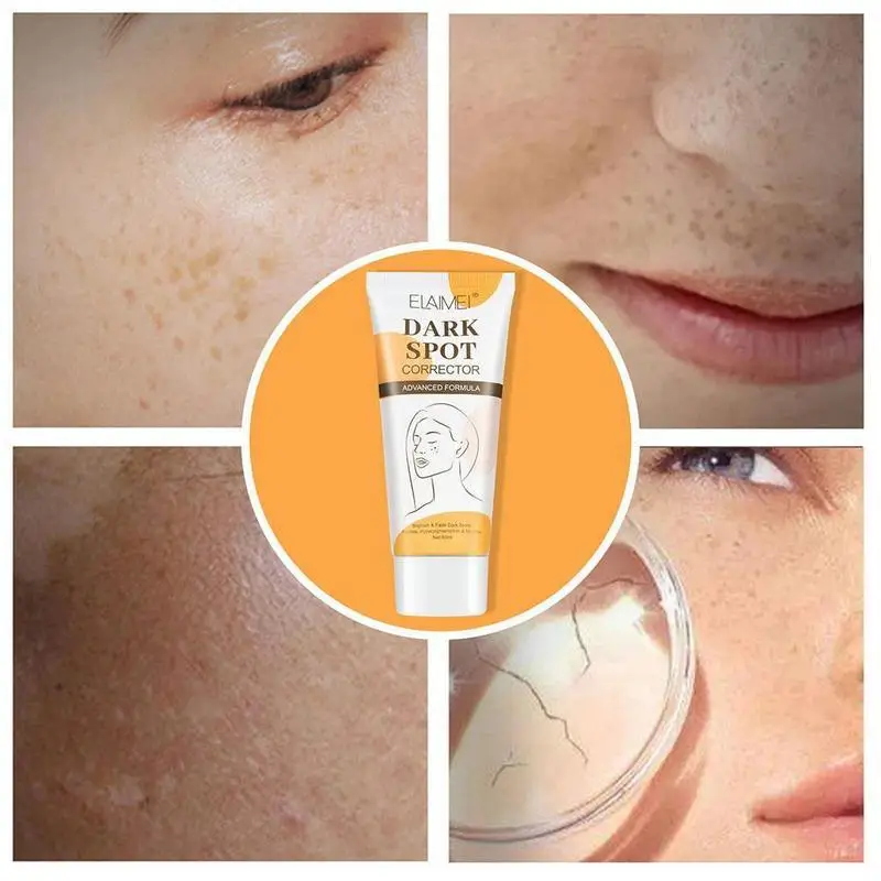 

Whitening Cream Lightening Blemish Removal Serum Brightening Marks Repair Concealer Freckles Reduce Scar Cream M3Z0