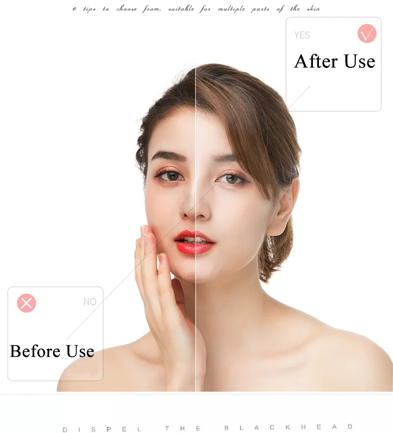 Blackhead Remover Acne Pore Cleaner Vacuum Electric Nose Face Deep Cleaner Pimple Remover Suction Facial Diamond Skin Care Tool