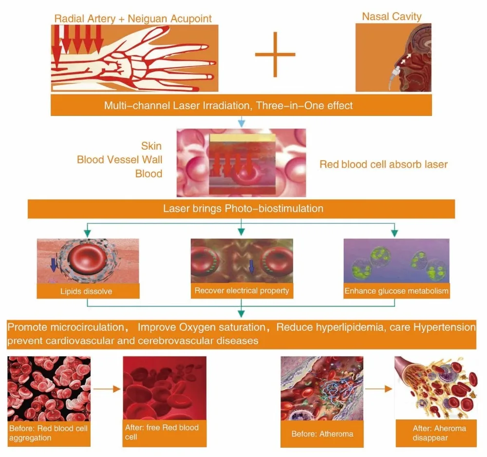Низкоуровневые лазерные наручные часы 650 нм гипертония гиперлипидемия диабет