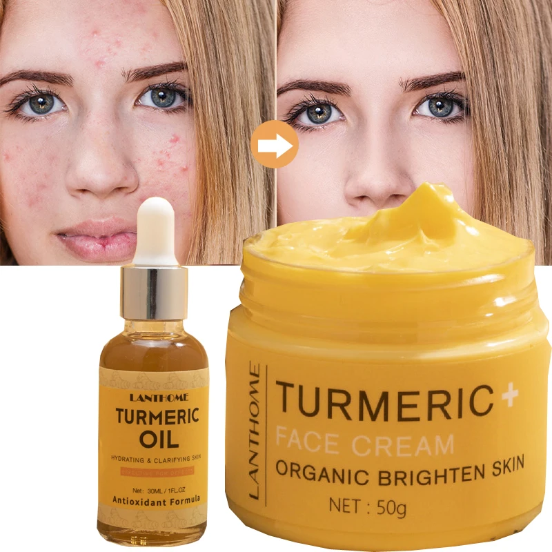 

2Pcs/Set Turmeric Cream Natural Organic Whitening Moisturizing Shrink Pores Lighten Dark Spots Facial Essence Oils Nourish Serum