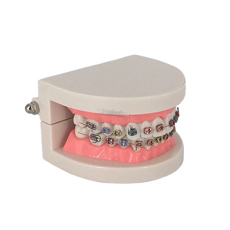1 шт. Стоматологическая Ортодонтическая модель для лечения зубов с Орто