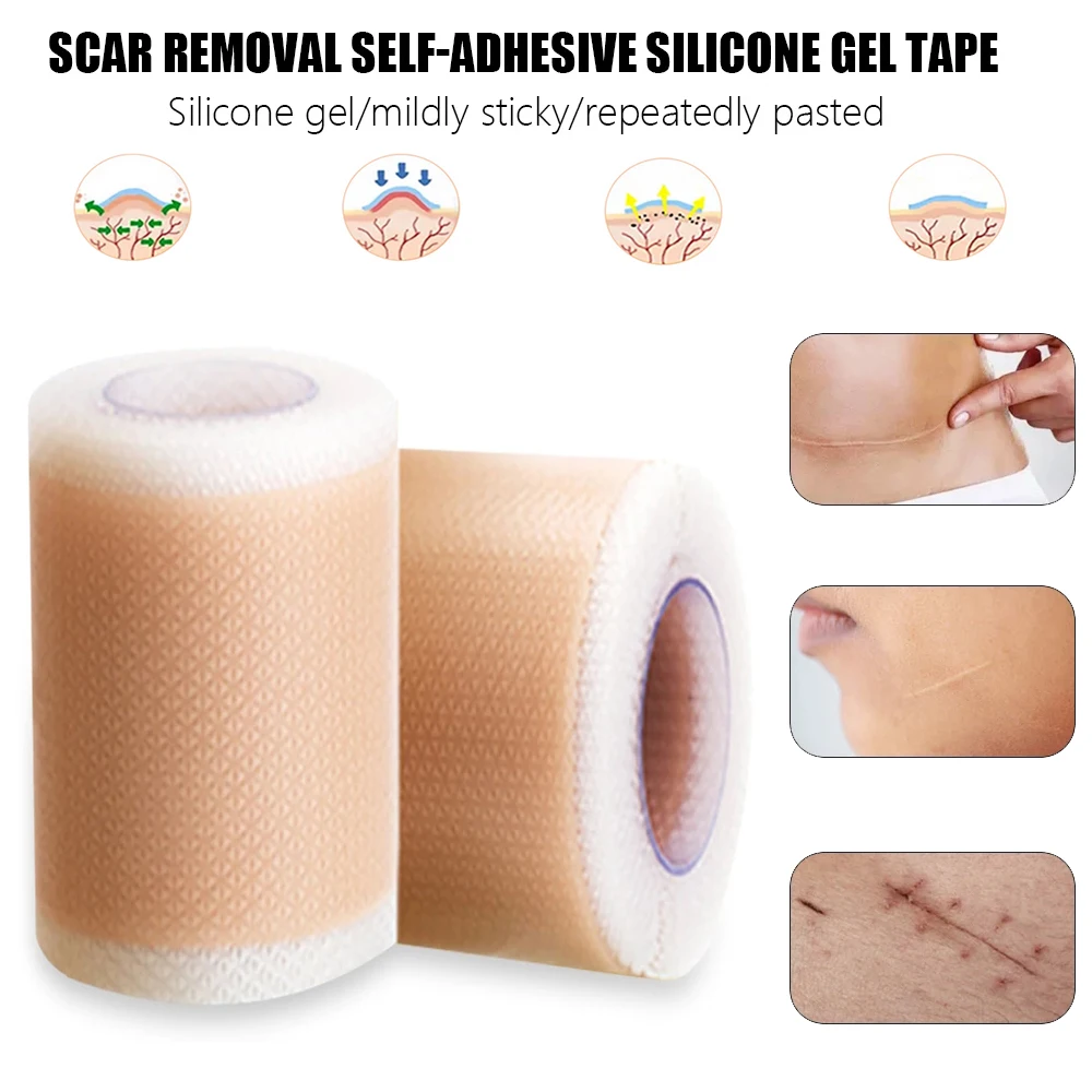 

Эффективное средство для удаления шрамов от красоты, искусственная кожа, лента для удаления акне, сжигания, уменьшения травм, наклейка для к...