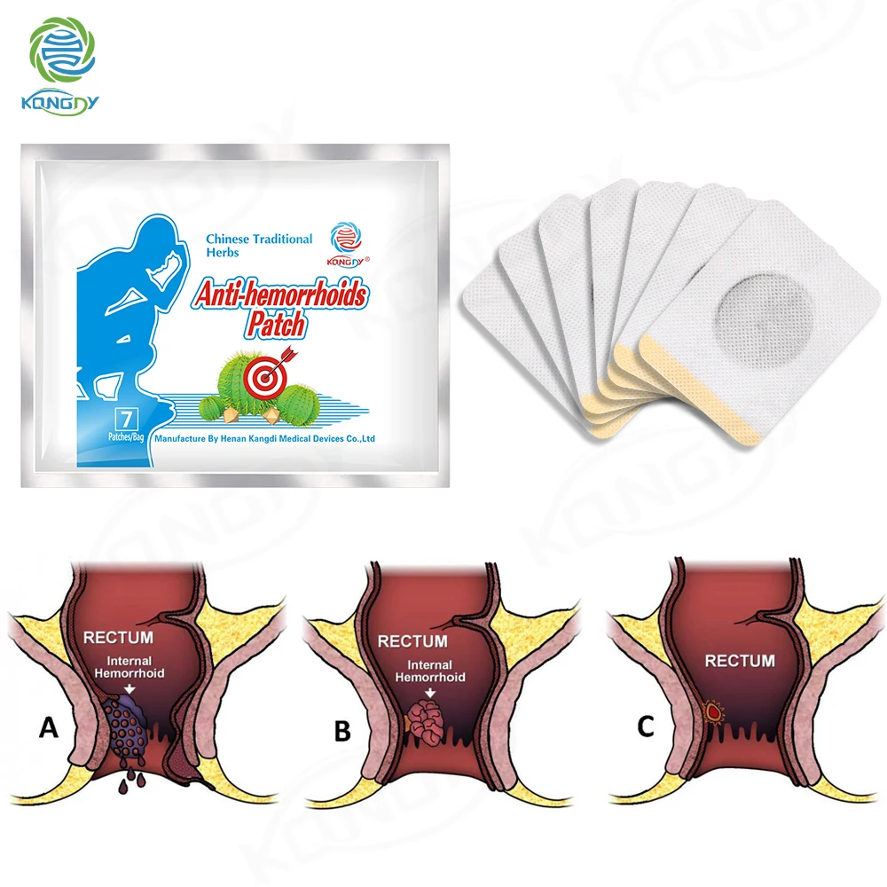 21 шт. пластырь от геморроя внутренней и внешней | Красота здоровье