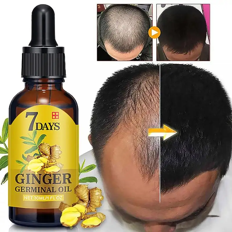 

Ginger Hair Growth Liquid Anti Preventing Hair Loss Faster Ginger Repair Serum Nourish Hair Oil Treatment Growing D3M4