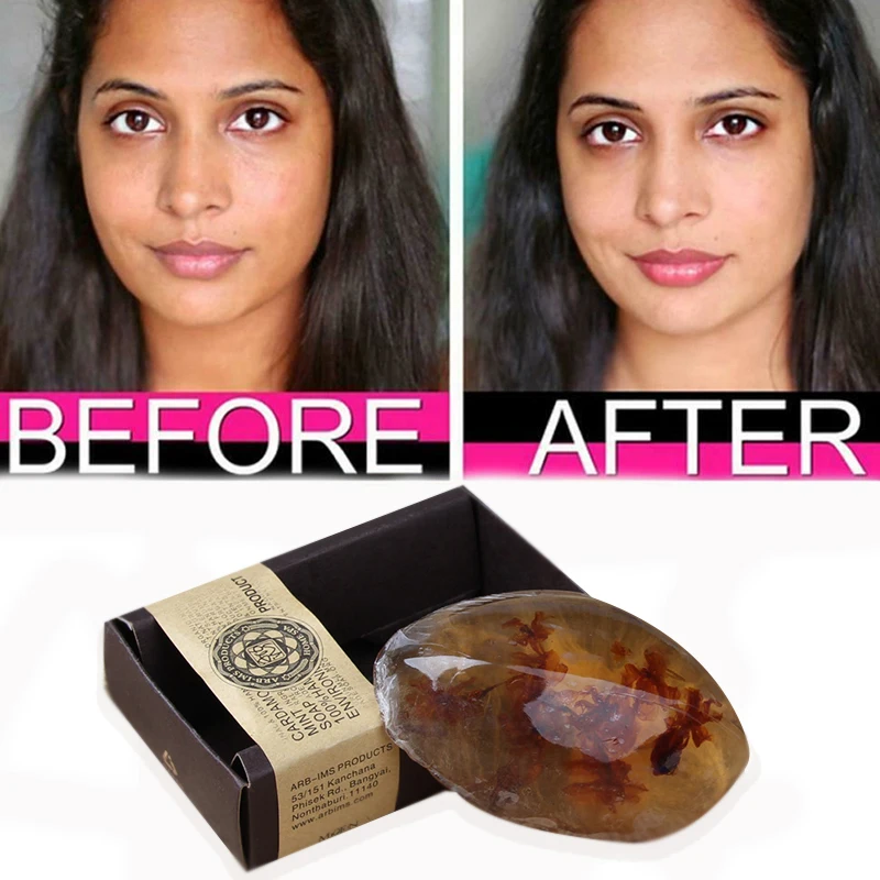 

Эфирное масло натуральное мыло ручной работы завод Отбеливающее мыло Управление масла османтус мыло увлажняющий ярче для восстановления к...