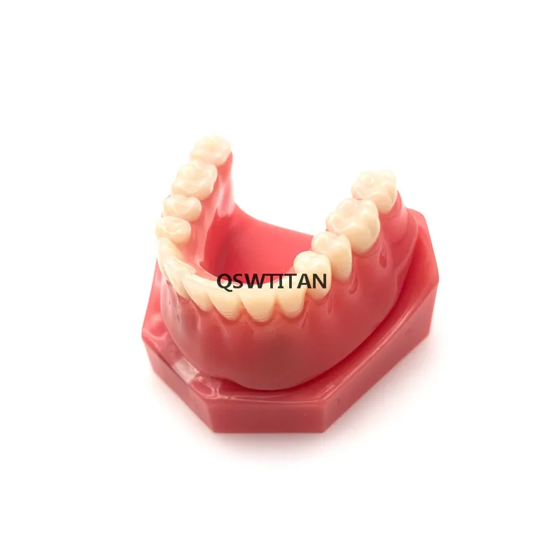 Стоматологическая уступает имплантат Overdenture 6007 модель зубов 2 импланты с