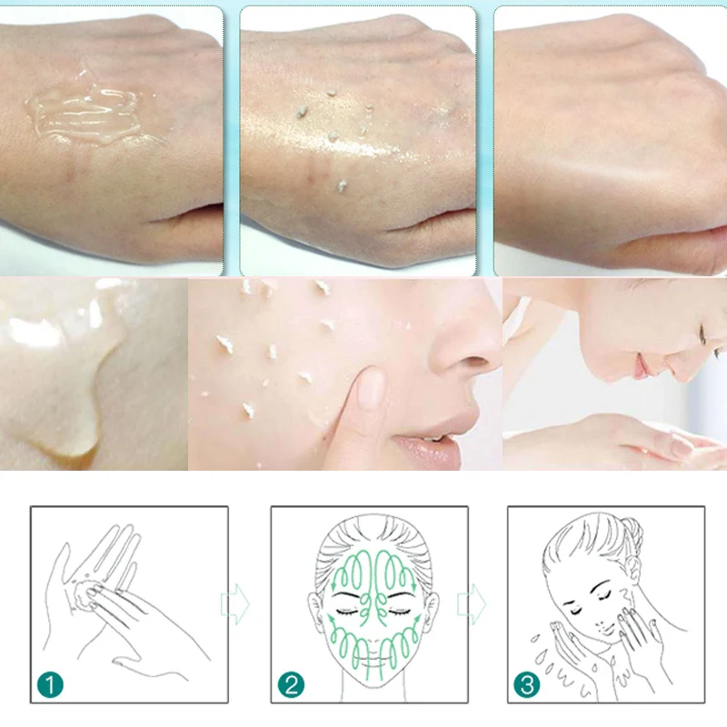 ОТШЕЛУШИВАЮЩИЙ ПИЛИНГ для лица гель глубокой очистки от угрей удаления контроль