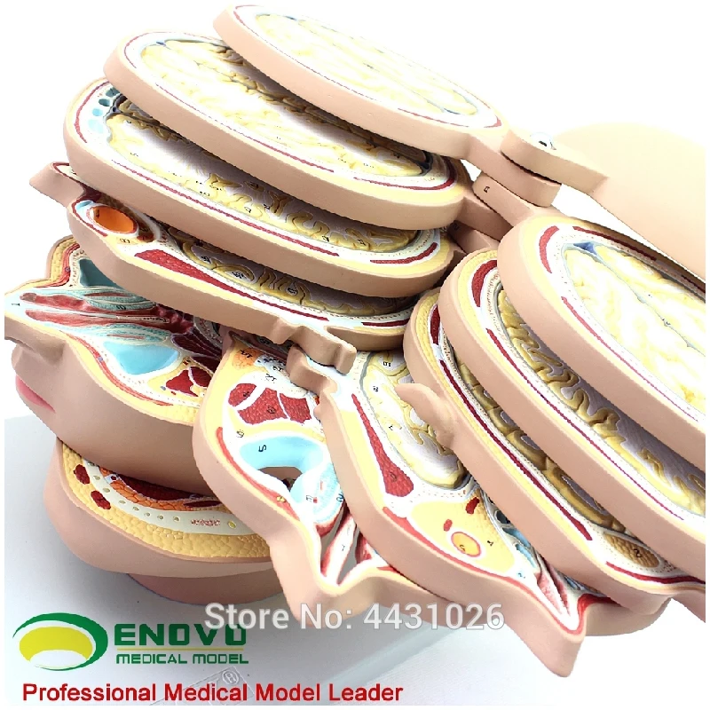 Эново мозговая транссекция модель для медицинского мозга КТ mrт магнитно