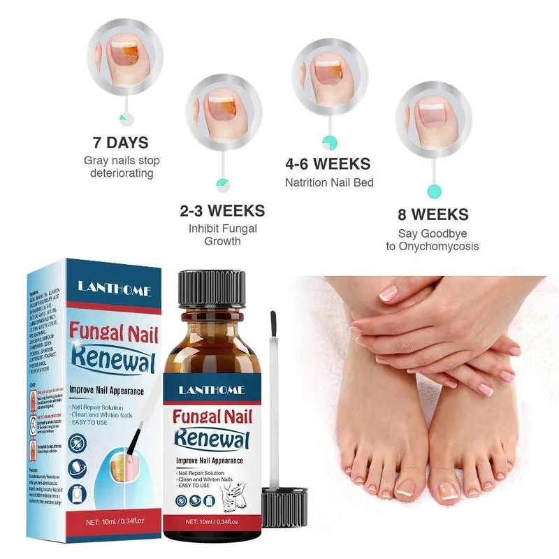 

LANTHOME 10ml Fungal Nail Repair Serum Toe Nourishing Nail Hand Onychomycosis Anti Foot Remove Treatment Fungal Infection O2X6