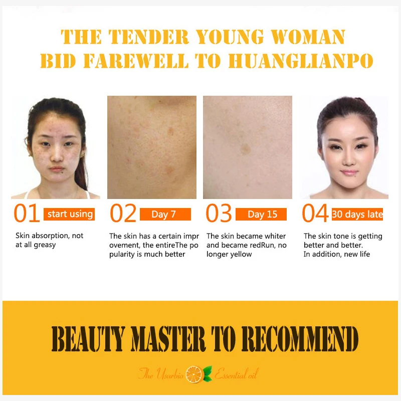 30 мл чистый витамин C гиалуроновой кислотой Сыворотки уход за кожей лица против