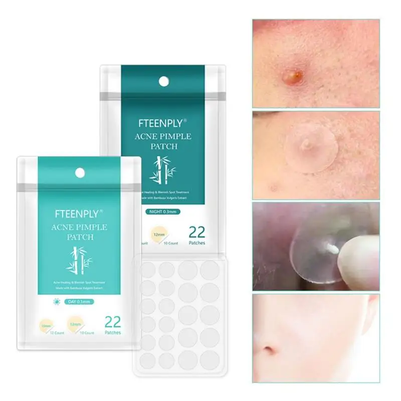 Acne Remover Sticker Tea Tree Pimple Patch Invisible Stickers Effectively Remove Treatment Pimples Skin Care TSLM2 |