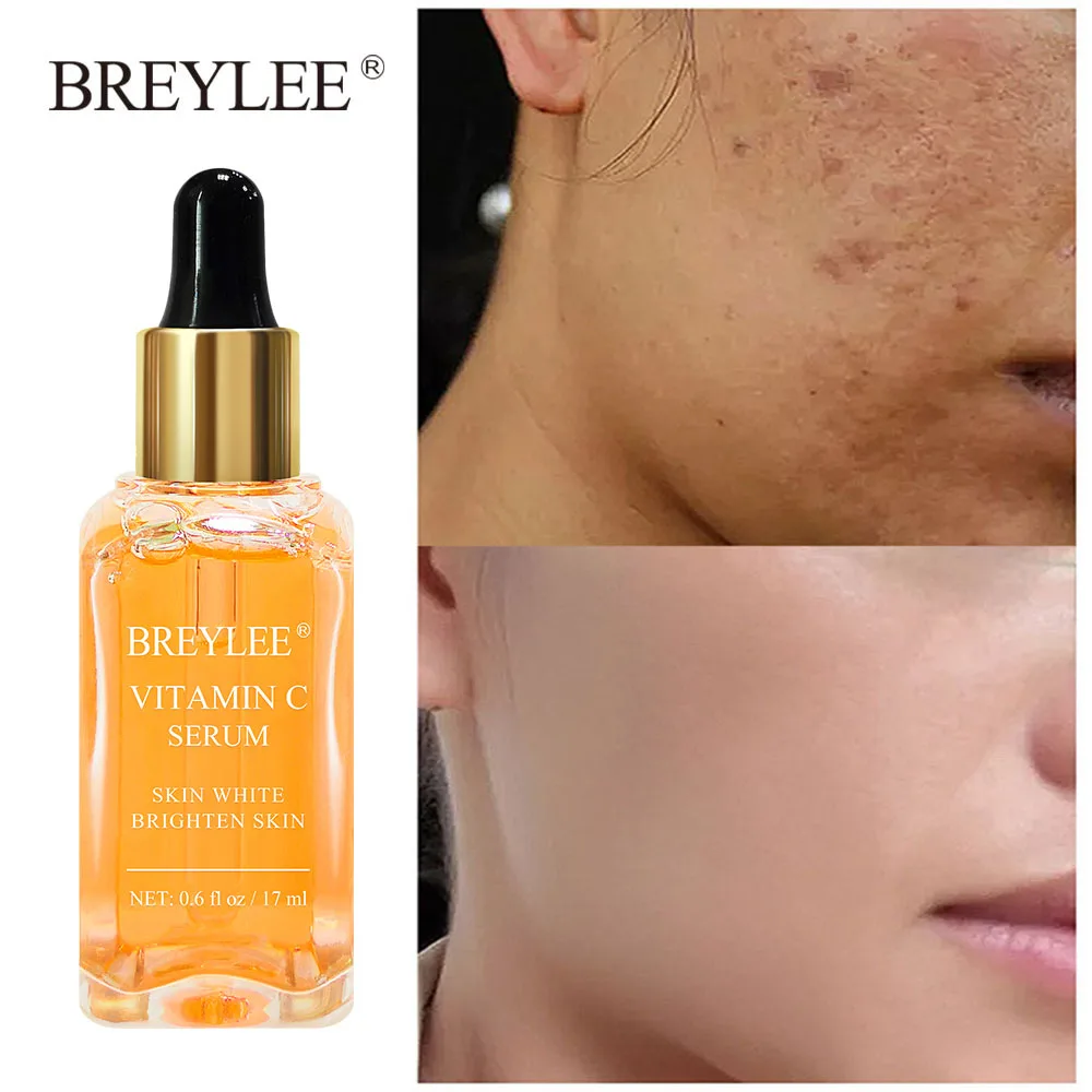 BREYLEE витамин C отбеливающая лицевая сыворотка коллаген инъекции гиалуроновой
