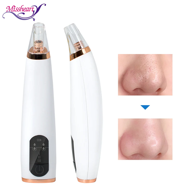 Средство для удаления черных точек с черными точками прыщей пор и акне