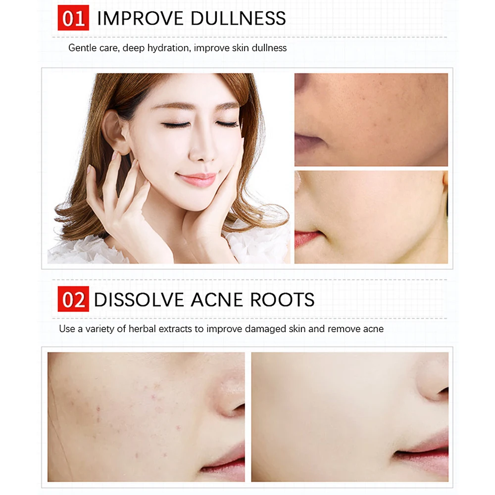 30ml Herbal Acne Repellent Skin Cream Mild Hydrated Oil Control Improve Dullness Promote Absorption Smoothing Brighten Face Care |