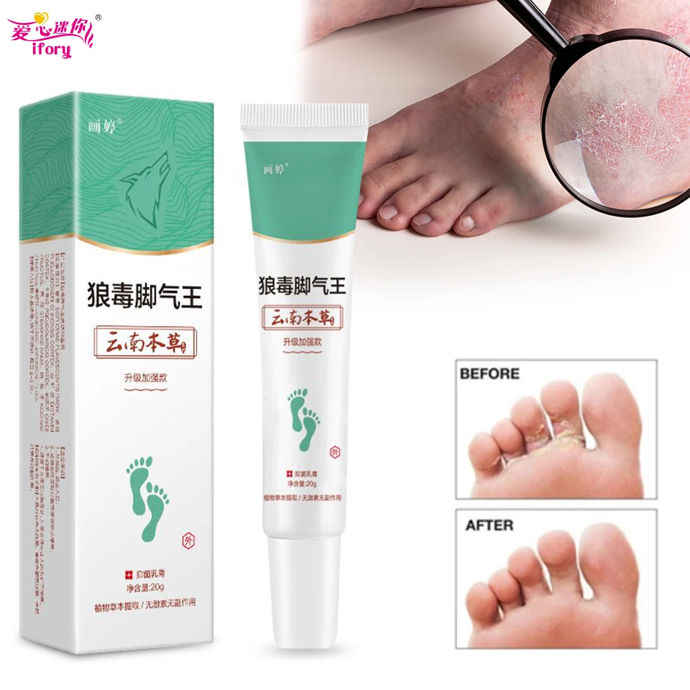 

Ifory Foot Cream Beriberi Curing Cream Chinese Herbal Patch Athlete's Foot Treatment Cream Anti-Itch Sweat Odor Feet