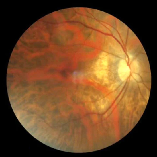 Портативный портативный ретинограф для Ретинальной Камеры|Запчасти и