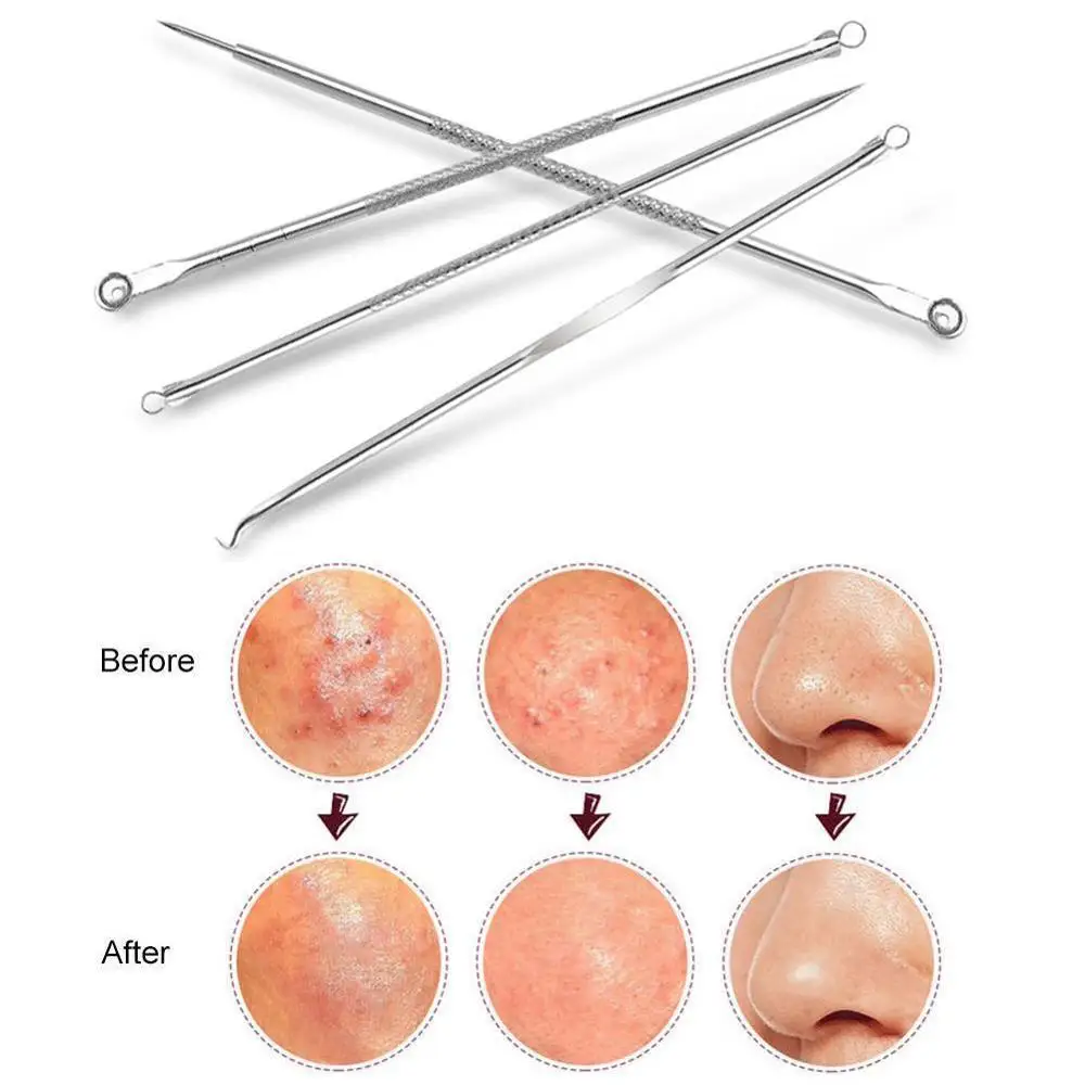 

4PCS Blackhead Extractor Blackhead Needle Black Dots Cleaner Acne Blemish Remover Needles Set Black Spots Pore Cleanser Tool
