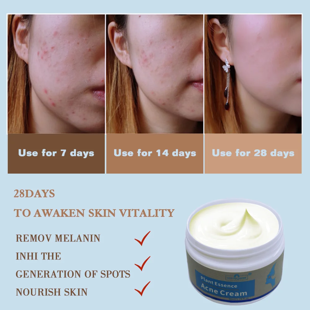 Крем для удаления акне 50 г контроль жирности сужение пор удаление шрамов угрей