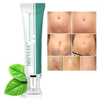 1pcs removal scar cream face pimples scar stretch marks removal acne treatment whitening moisturizing cream skin care 30g