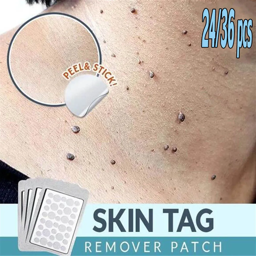 Skin Tag Remover Patch Ance Pimple Plaster Acne Cream Invisible Hydrocolloid Master Anti-infection Absorb Face Care |
