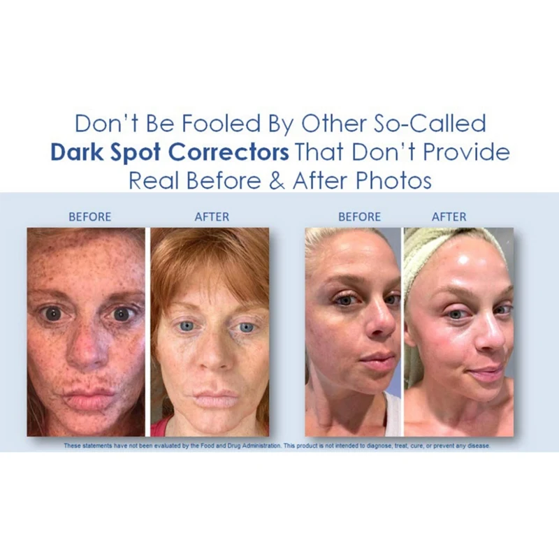 

2020 New Facial Whitening Serum Moisturizing Firming Skin Brighten Skin Tone Remove Freckle Cream