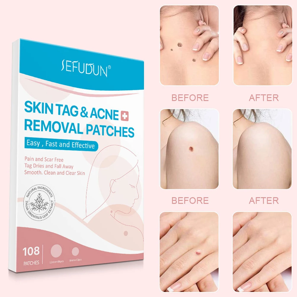 

1 Box of 108Pcs Acne Remover Patches Skin Tag Removal Patches Acne Remover Patches Skin Care Makeup
