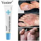 Антибактериальный крем Yoxier, лечение псориаза, покраснения кожи