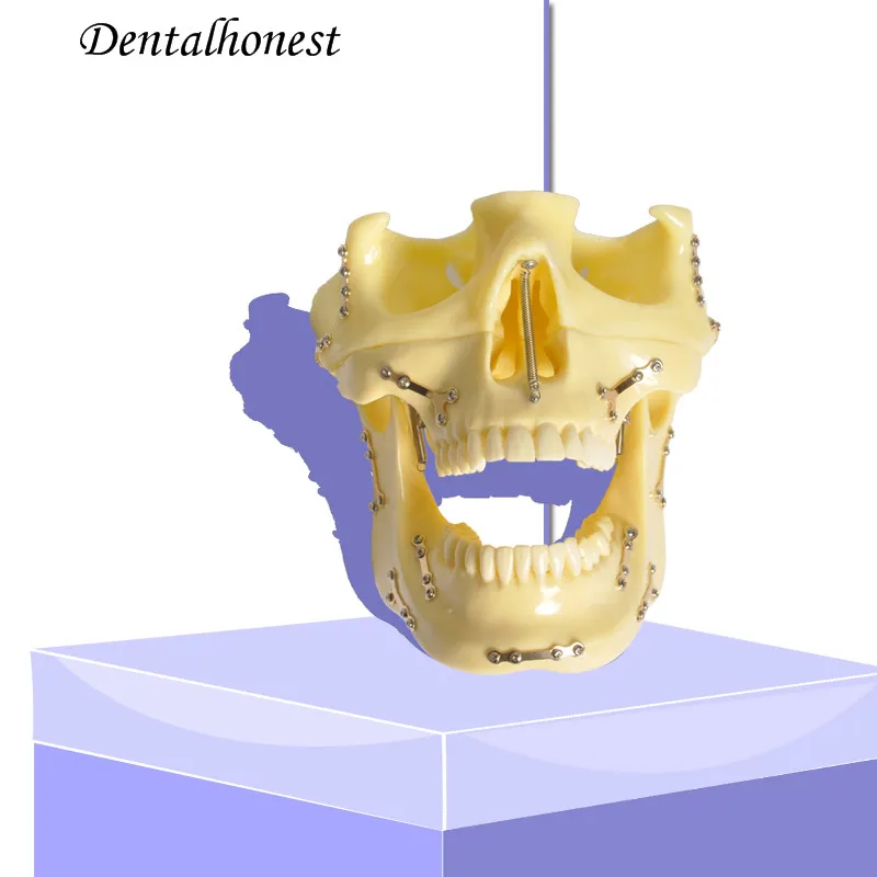 Dental model 2016  Anchor Implant Screw Practice Model