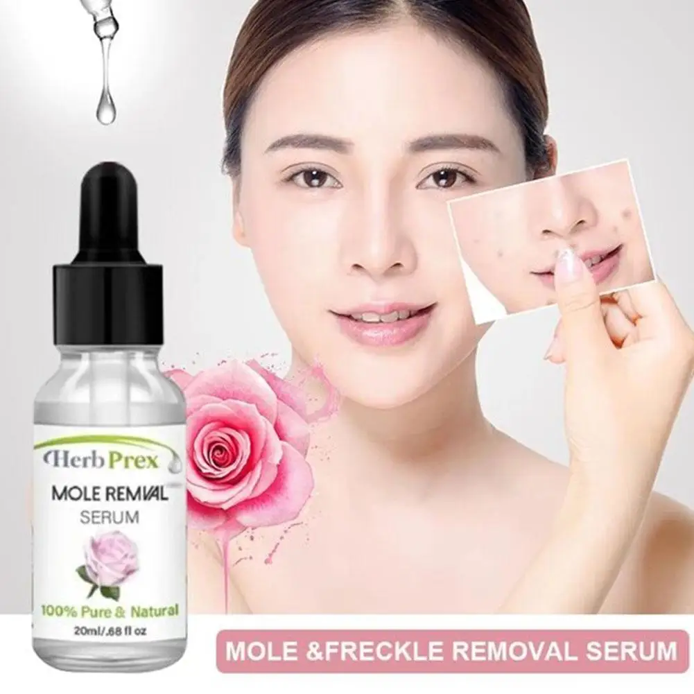 

Liquid Wart Mole Removal Serum 20ML Organic Tags Solutions Freckle Spot Mole Essence Serum Remover Fast Skin Care Tag Skin A7Y9